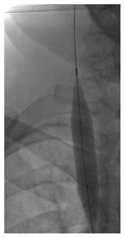 [RIJV full inflate 01[2].jpg]