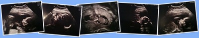 Baby 1.0 Screenshots anzeigen