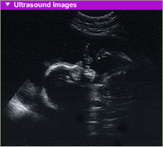 fetal development 7th month usg