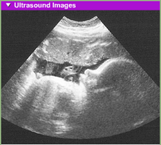 fetal development 9th month usg