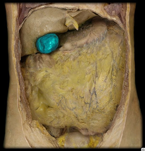 ~Ucla research on rock in the gallbladder how to remove: incontinence after gallbladder anatomy and physiology. ~Ucla research on rock in the gallbladder how to remove: incontinence after