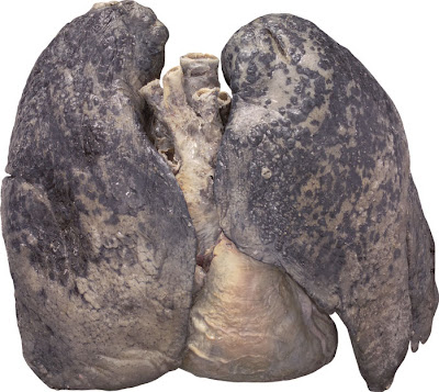 Lungs