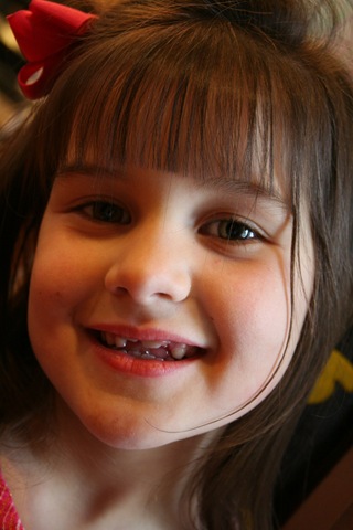 [KyliesLostTooth-2[2].jpg]