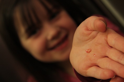 [KyliesLostTooth-4[2].jpg]