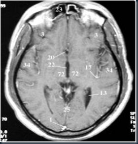 AnOtak Axial2