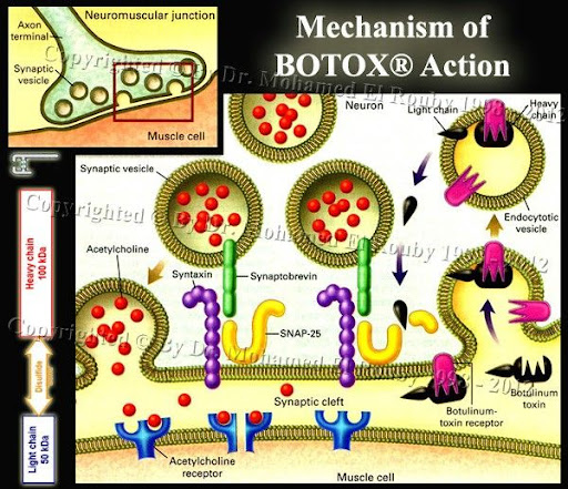 botox-action-mechanism.jpg