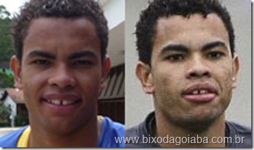 dentinho dentinho