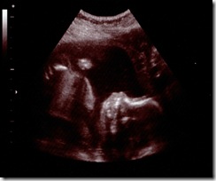 borderless profile  view