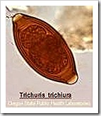 Trichuris ovo Trichuris ovo