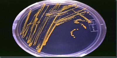Agar_plate_with_colonies