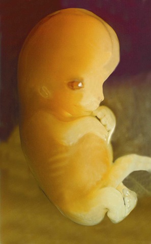 [fig20baby7[4].jpg]