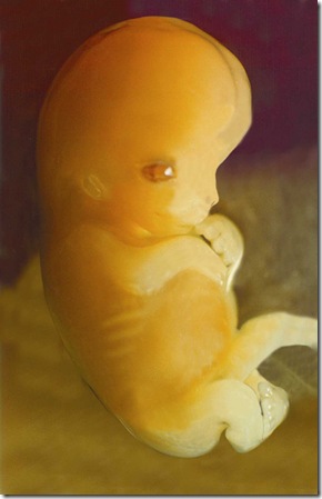 fig20baby7