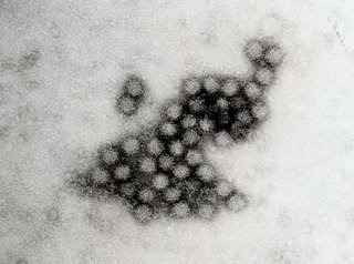 [norovirus-718760[3].jpg]
