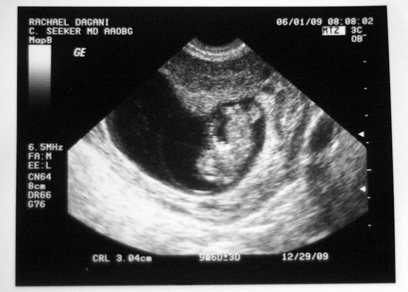 Baby due around Xmas