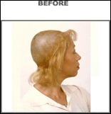 woman1-before