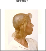 [woman1-before[20].jpg]