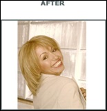 woman1-after