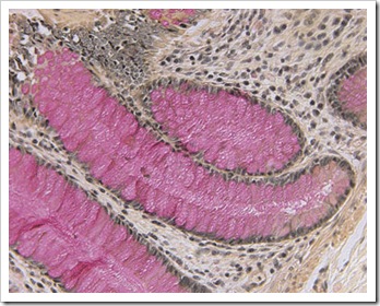 (860-011)Mucicarmine-bowel