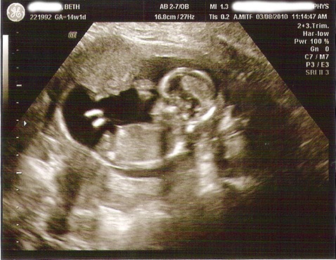 baby_1