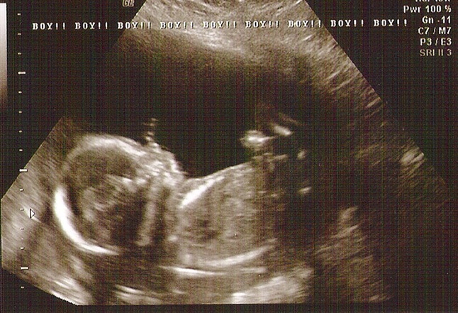 20weeks
