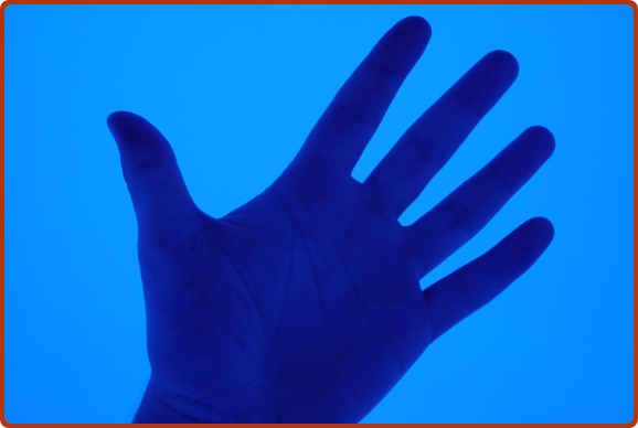 ArthritisHand.png Arthritis-Hand Moshe