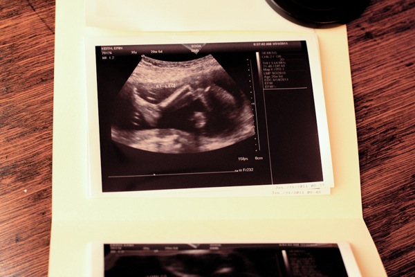 Baby 3