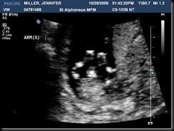 MILLERJENNIFER20091029134221544