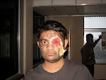 Jignesh