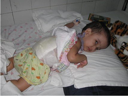 Successful surgery for 14 month old