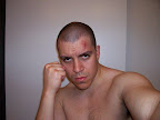 Lumped up after a serious sparring session...