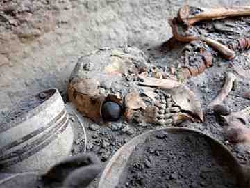 The world's oldest artificial eyeball was found on a female skeletal remains.