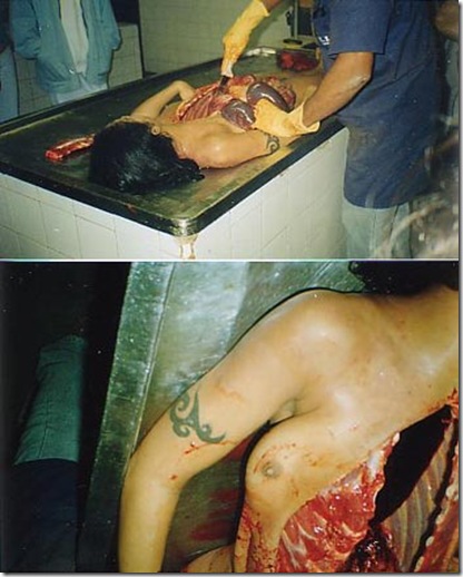 autopsia 3