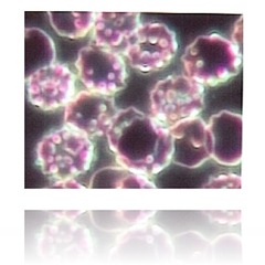 C pneumoniae C pneumoniae