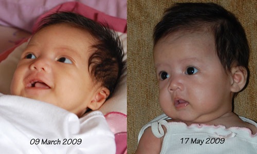 [thennow_abi[6].jpg]
