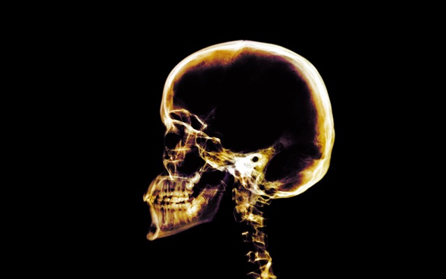 [(7)HD-X-Ray-View-Desktop-Wallpaper-Skull[2].jpg]