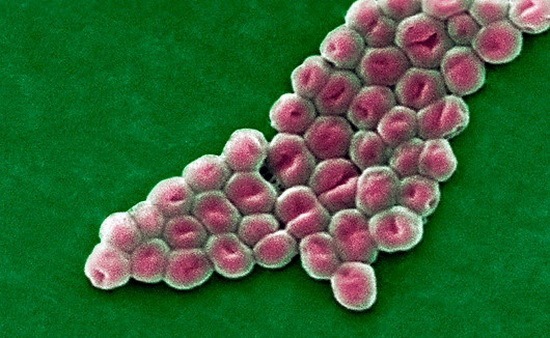 Acinetobacter baumannii Acinetobacter baumannii