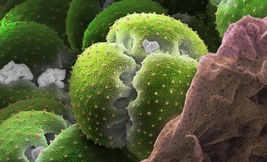 [amazing_pollen_grains_under_microscope_06[2].jpg]