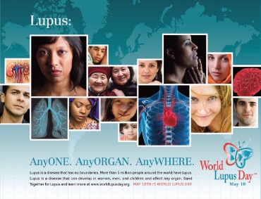 [lupus poster[3].jpg]