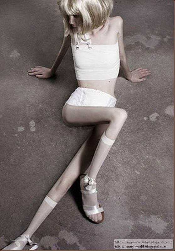 skinny-anorexic-models (2)
