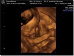 18 week ultrasound 4d 18 week ultrasound 4d
