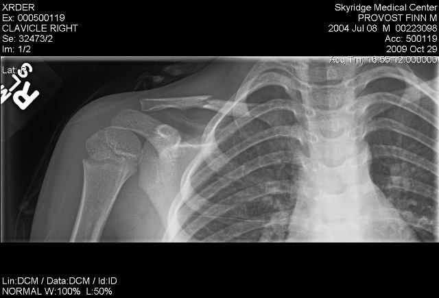 [Finn-Xray-10002[5].jpg]