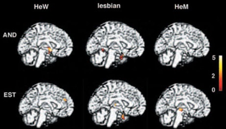 [lesbian_brain[3].jpg]