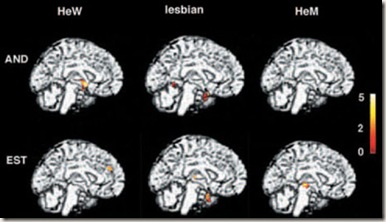 lesbian_brain lesbian_brain