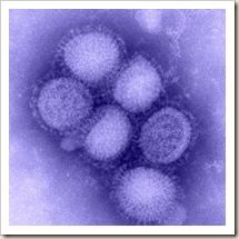 SwineFlu