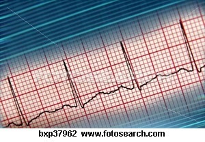 [electrocardiogramme[2].jpg]