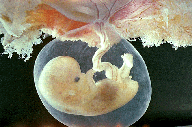 [placenta[2].gif]