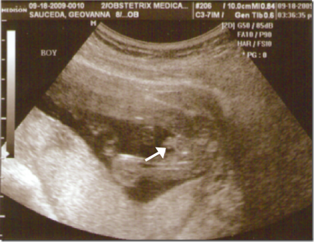 UltraSound-Sexo