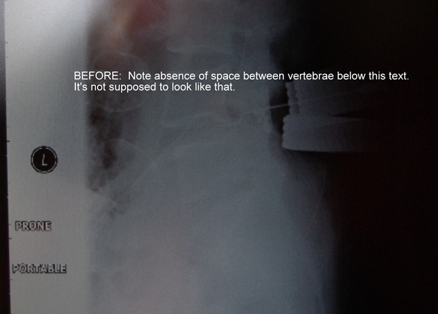 [surgery before[3].jpg]