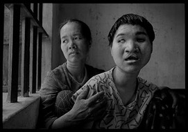 deformed-daughter-vietnam[1]