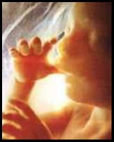 contra el aborto
